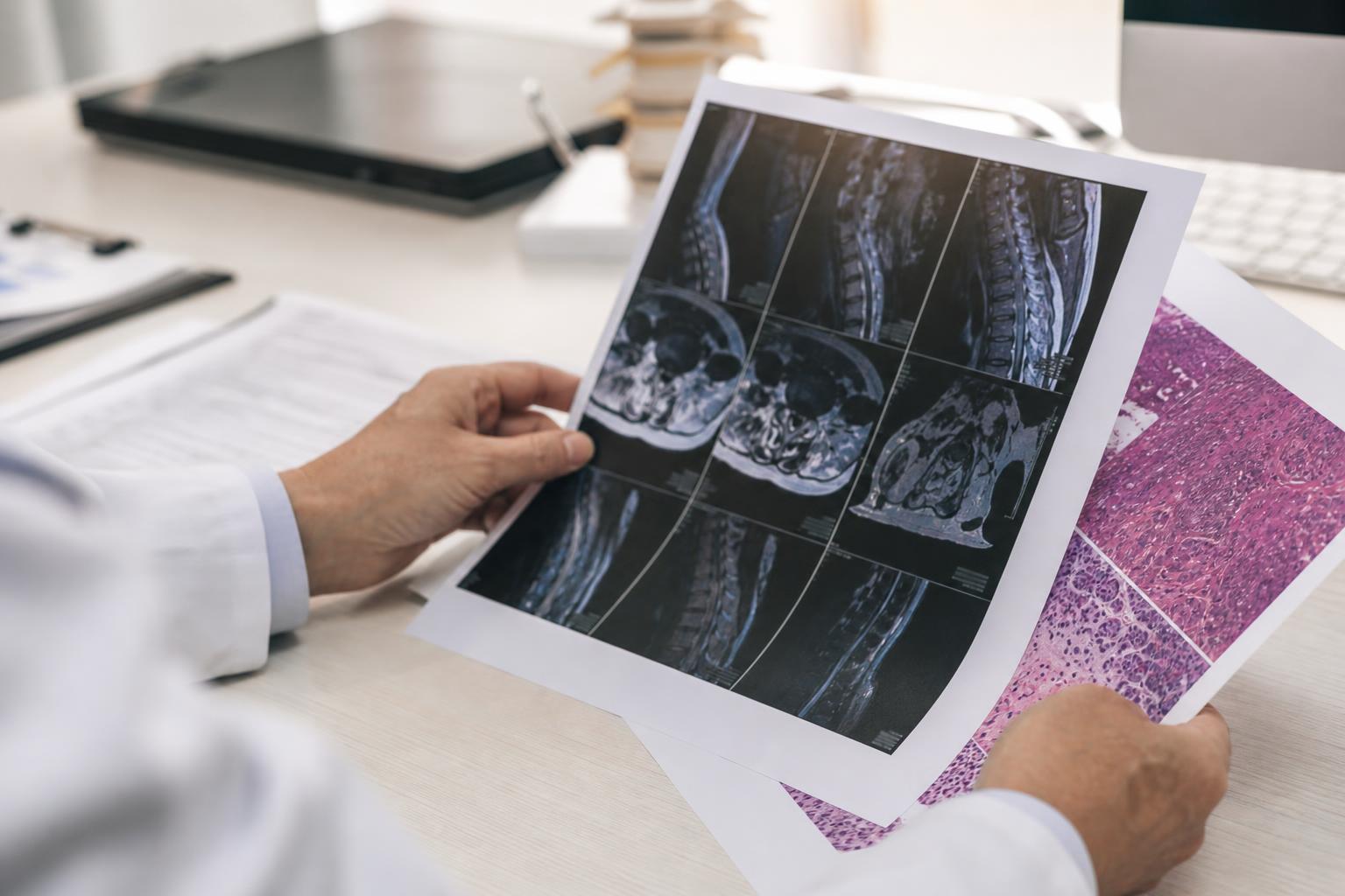 Medical reports, MRI scan and DNA strand